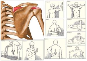 Curare I Dolori Alla Spalla Con Osteopatia E Fisioterapia